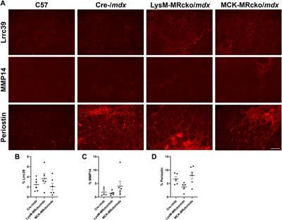 Cell-type specific effects of mineralocorticoid receptor gene expression suggest intercellular communication regulating fibrosis in skeletal muscle disease